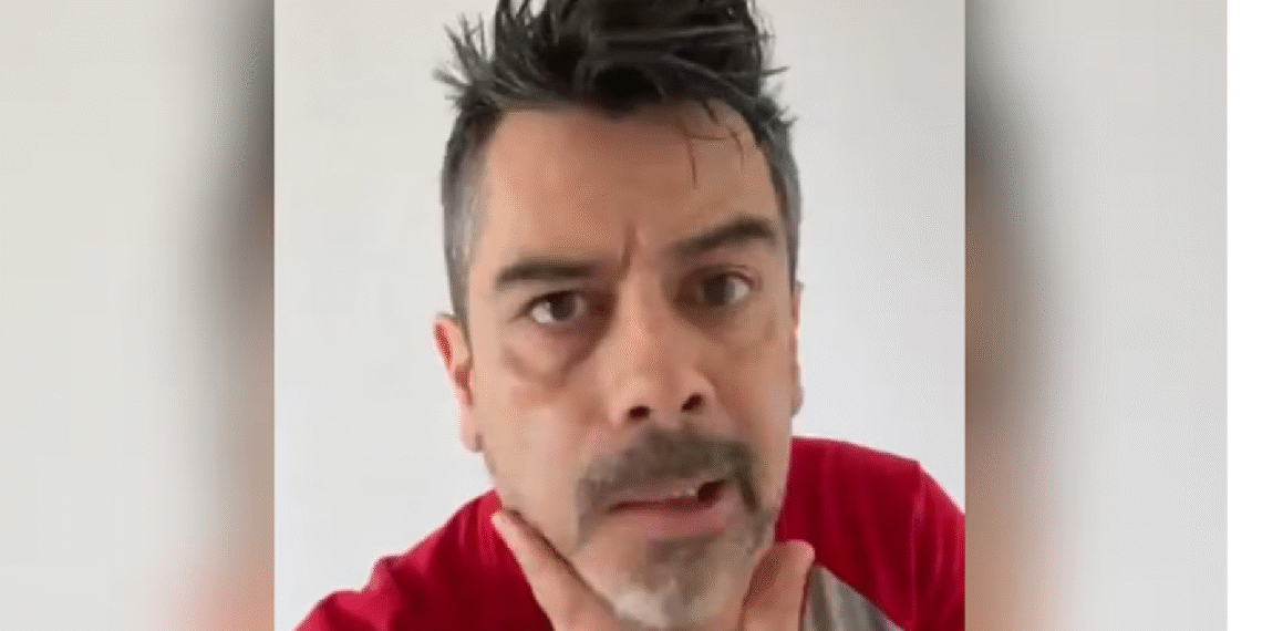 Carlos Espejel aparece con parálisis facial; atribuye su estado al estrés