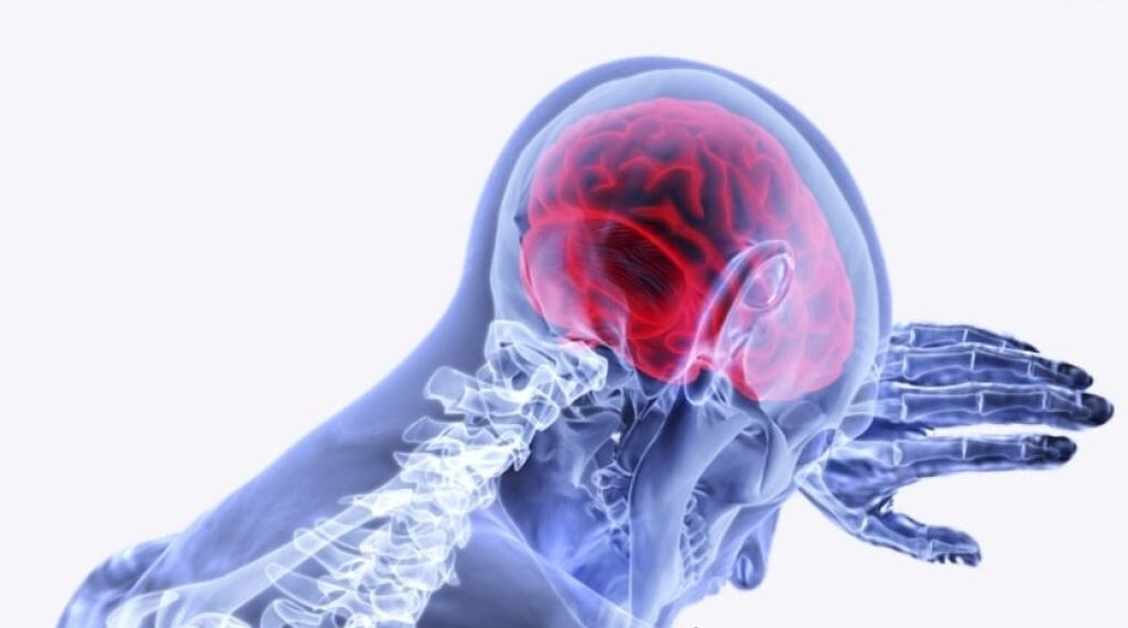 Enfermedad Vascular Cerebral, prevenible en 90% de los casos: Instituto Nacional de Neurología y Neurocirugía