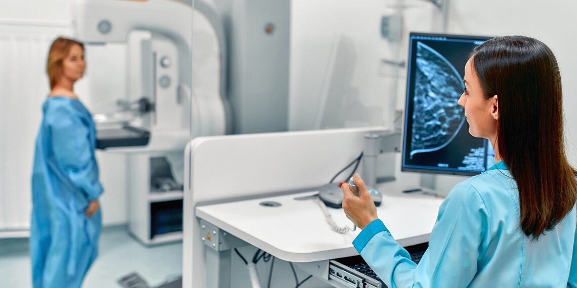 No pierdas tiempo, la mamografía debes hacerla en edad temprana