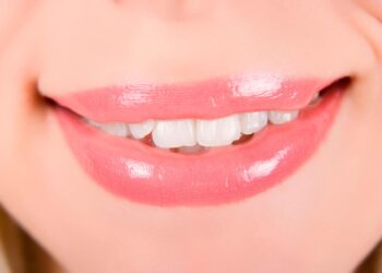 La sonrisa ideal ¿es sólo para chavos?