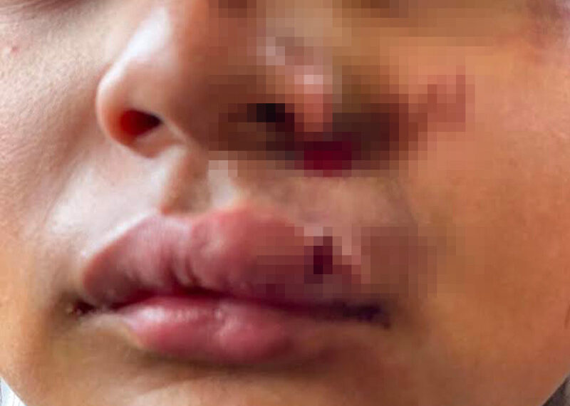 Exhiben golpes a Monse en primaria Rébsamen en Oaxaca