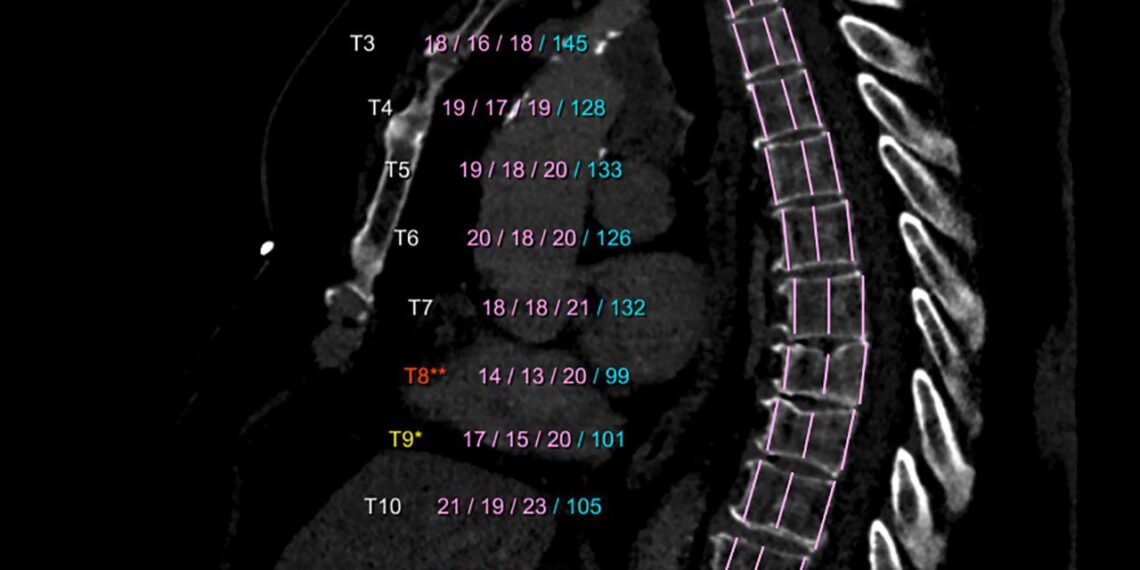 Siemens Healthineers y CHRISTUS MUGUERZA anuncian sinergia para uso de Inteligencia Artificial, en favor de la salud