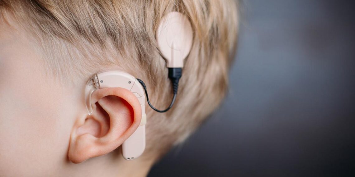 Implantes cocleares: tecnología que permite disfrutar de los sonidos a las personas con hipoacusia