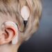 Implantes cocleares: tecnología que permite disfrutar de los sonidos a las personas con hipoacusia