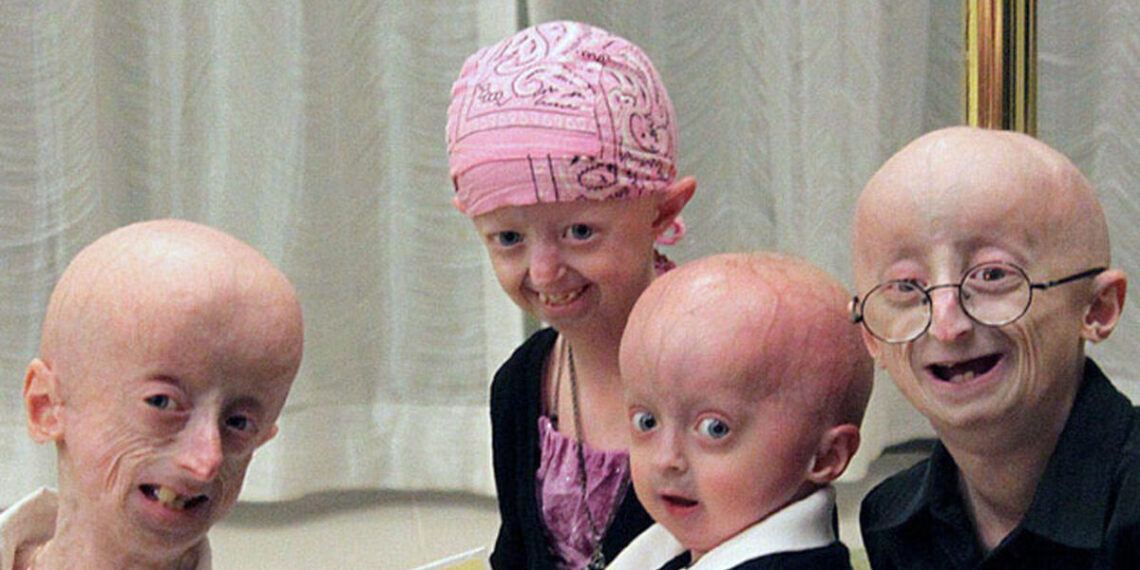 Al menos 10 millones de personas viven con una enfermedad rara en el país