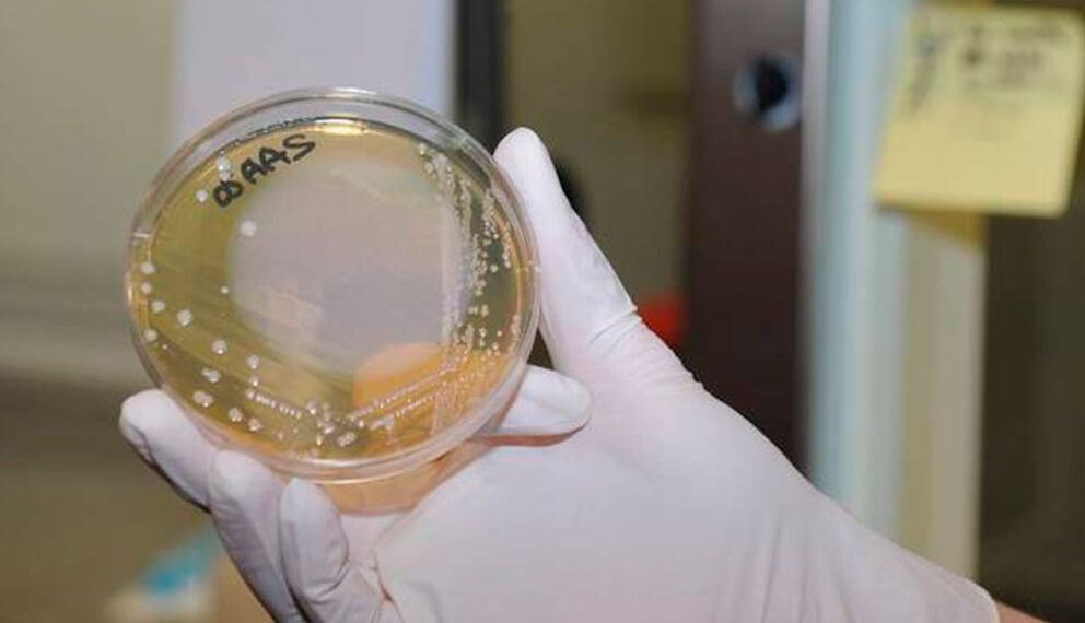Alertan aumento de casos de una ‘bacteria carnívora’ que está afectando a Japón