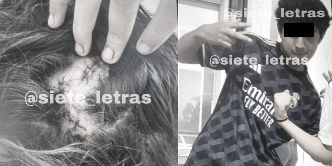 Dan de alta a menor apuñalada en en Iztapalapa