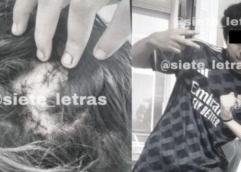 Dan de alta a menor apuñalada en en Iztapalapa