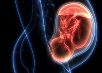 La preeclampsia, desafío importante en la prevención prenatal y obstetrica en México