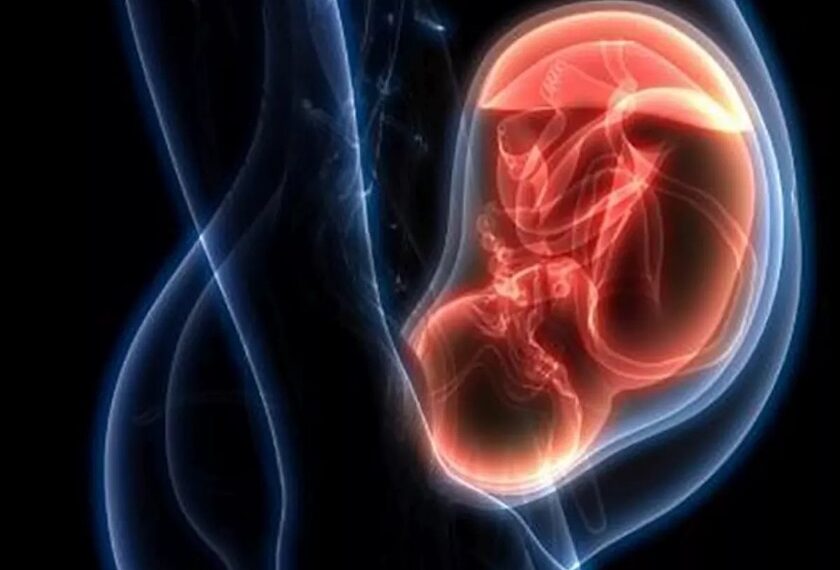 La preeclampsia, desafío importante en la prevención prenatal y obstetrica en México