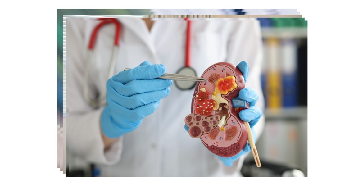 Detección y tratamiento oportuno: claves para el éxito en pacientes con ERC