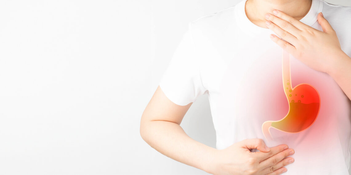 Terapia y cirugía de punta para tratar casos complejos de hernias hiatales y ERGE