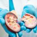 Deben vacunarse VS Hepatitis personas con ERC