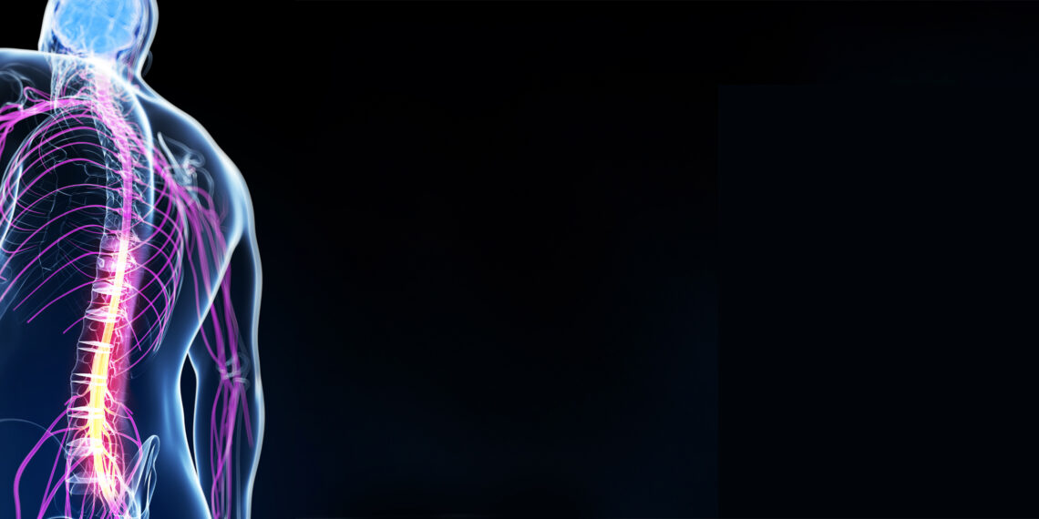 Estimulación espinal no invasiva. Tratamiento de punta en parálisis de extremidades