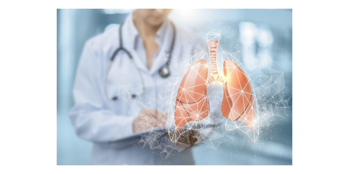Atención de comorbilidades mejora el pronóstico de vida en pacientes con Fibrosis Pulmonar