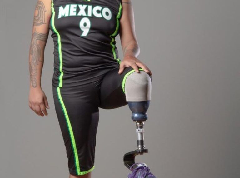 En México, en promedio 70 personas sufren amputaciones diarias