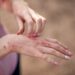 Seis pasos para prevenir los brotes de dermatitis atópica