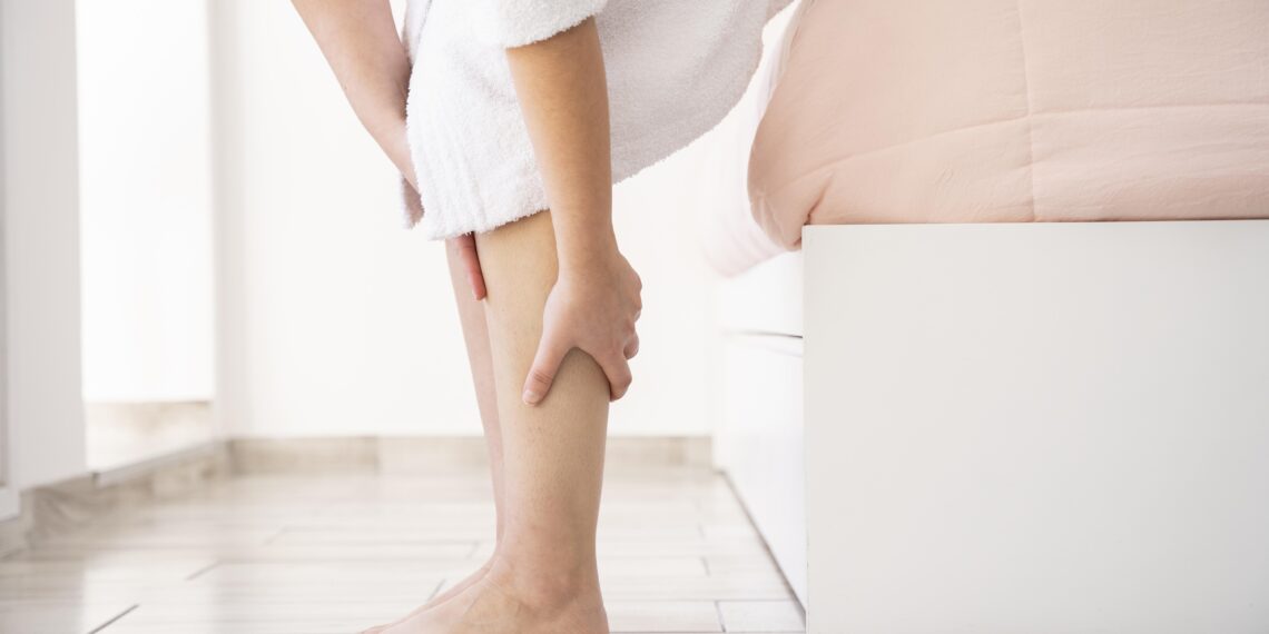 ¿Qué es la insuficiencia venosa y cómo afecta tu salud?