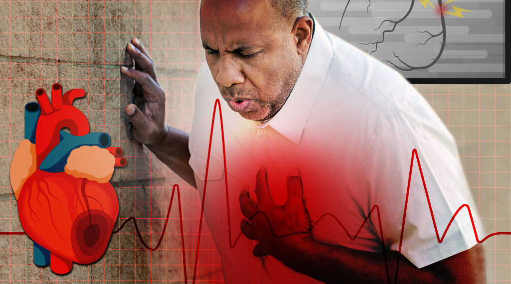 «Infarto agudo al miocardio: Conocer sus síntomas es decisivo para sobrevivir»