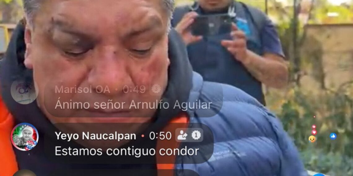 Liberan a dueño de Sonido Cóndor tras trifulca con policías: ‘Estoy muy lesionado’