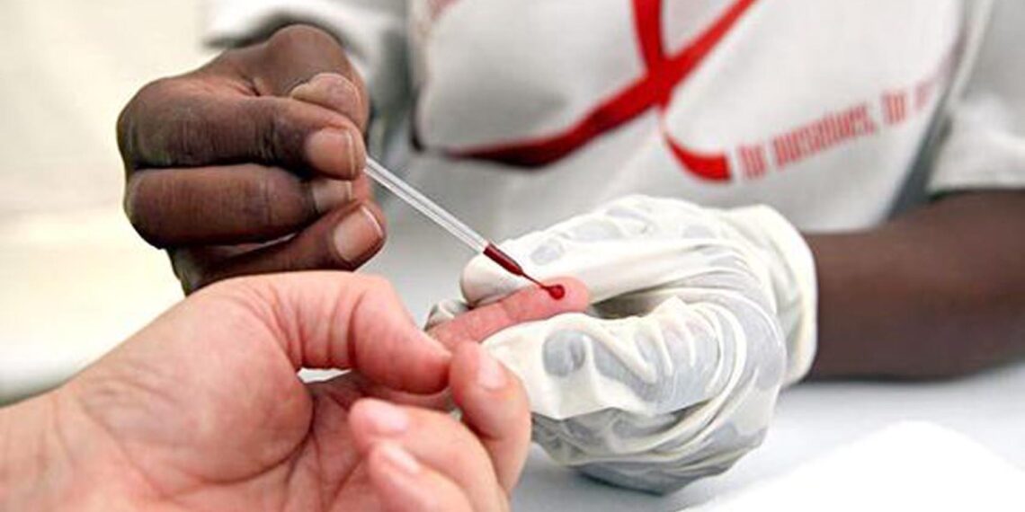 Al alza, casos de VIH en México