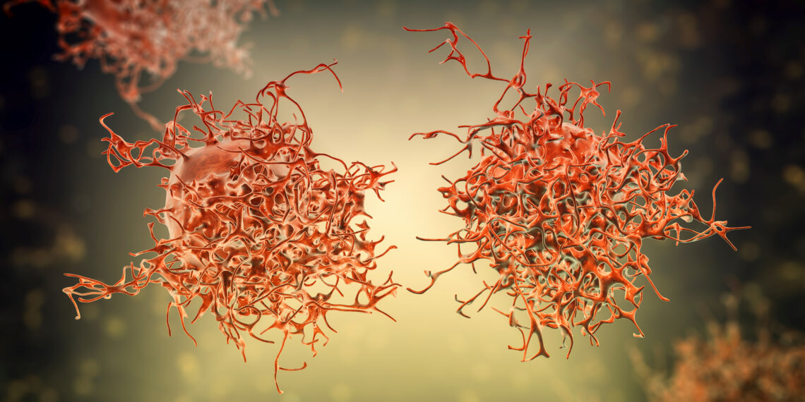 CÁNCER CERVICAL: cirugía abierta vs cirugía minimamente invasiva