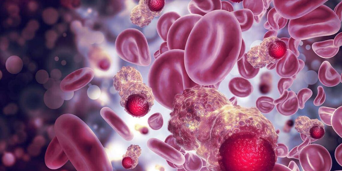 Necesario hablar de prevención y de diagnóstico oportuno del cáncer, especialistas