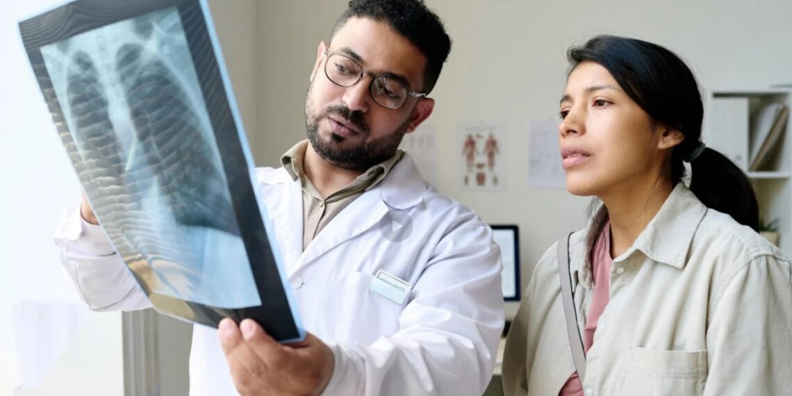 Fibrosis Pulmonar Idiopática y Esclerosis Sistémica: enfermedades raras y asfixiantes