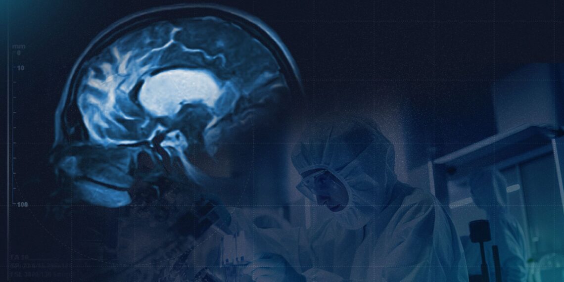 GEN y Sulfateq anuncian resultados positivos en fase 1 del fármaco SUL-238 para el Alzheimer