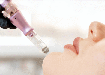 La revolución en el cuidado de la piel: Derma Pen, el secreto para una piel radiante