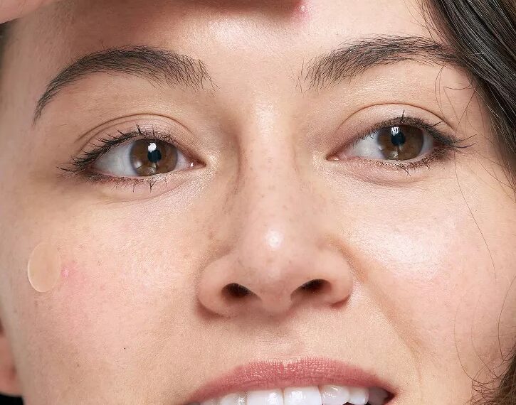 Hero Patch invita a amarte sin filtros