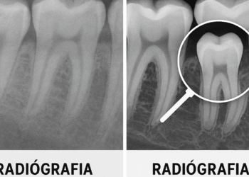 Dentistas digitales en México: planificación 3D para implantes más precisos y mejor diagnóstico