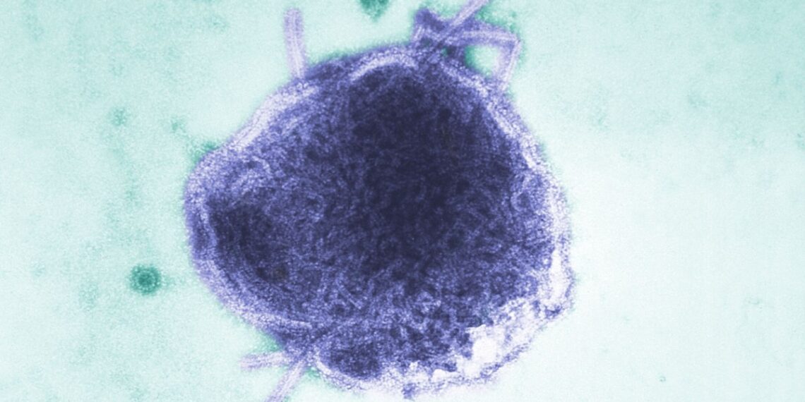 Secretaría de Salud advierte por sarampión: los siete estados que concentran el 85% de los casos en México