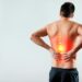 ¿Dolor de espalda que no desaparece? Podría ser Espondilitis Anquilosante